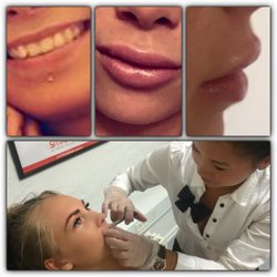 facial cosmedic surgery in denmark Great porn pussy close up pics