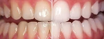 image of business Smiles of Johns Creek