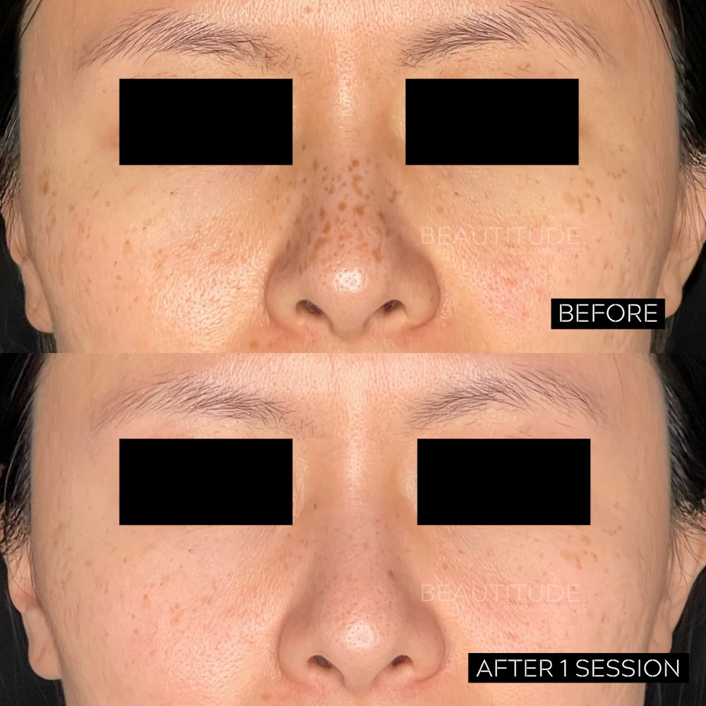 Beautitude Medical Aesthetics