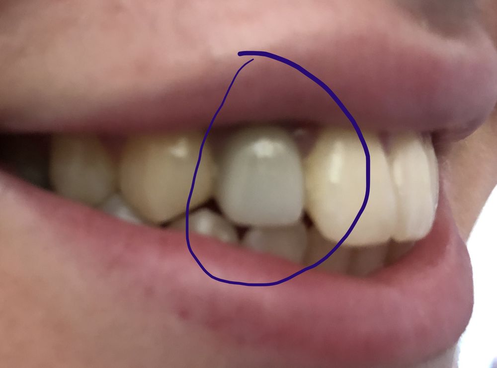 image of business DDS Dentures + Implant Solutions of Denton