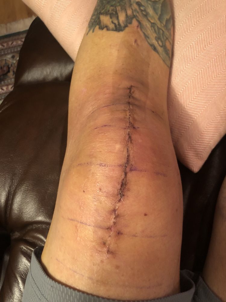 Catawba Valley Medical Center