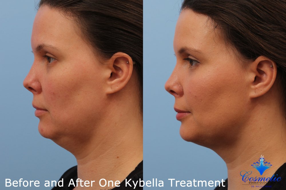 Cosmetic Dermatology Center