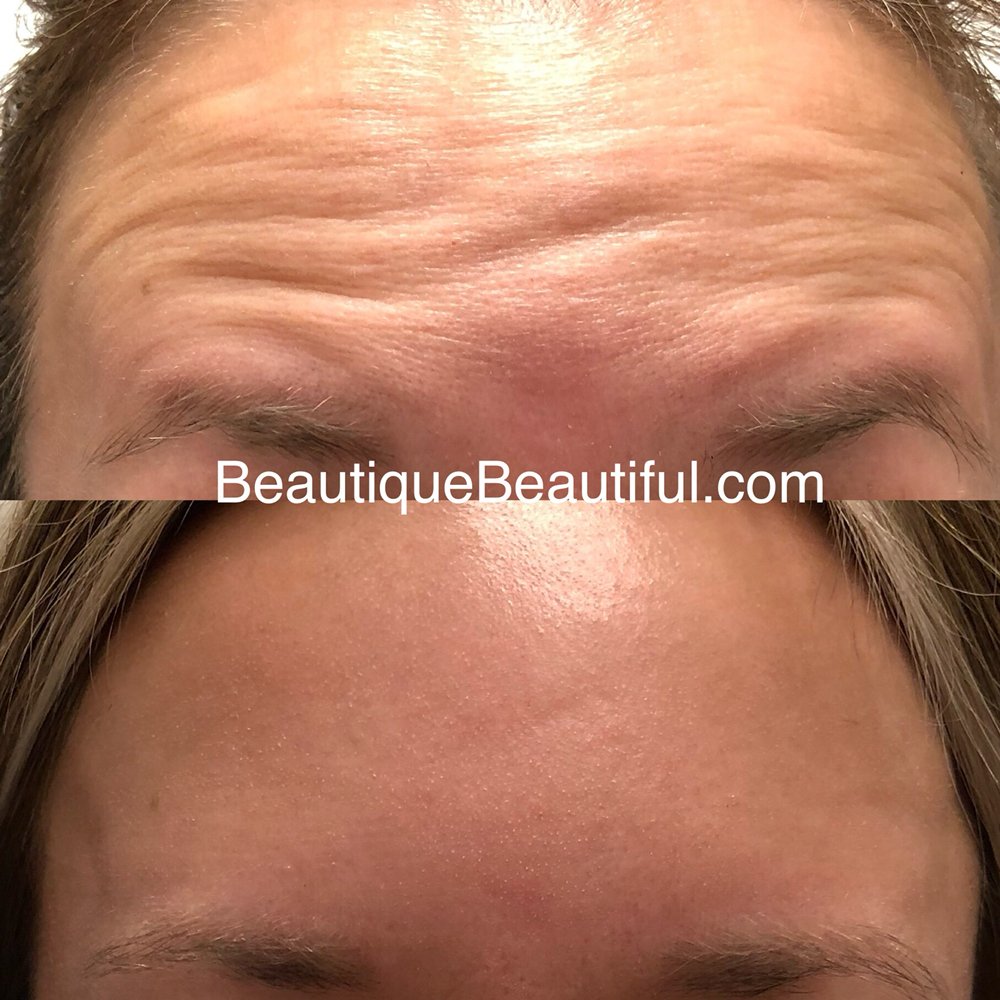 Beautique Medical AntiAging 112 Photos Medical Spas Knoxville