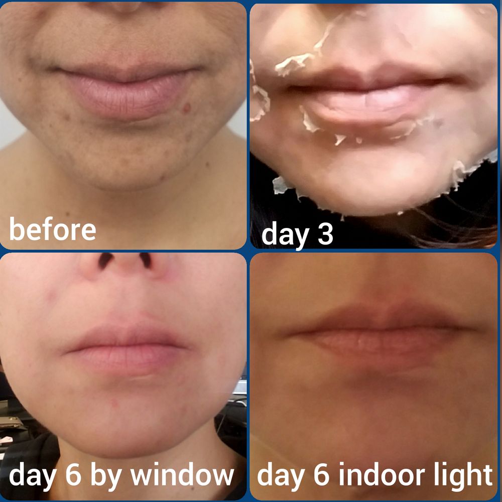 Pure Skin Medical