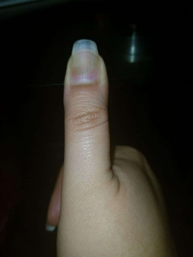 2nd Nail With Greenies From A Fill In At This Place Yelp Photo Of Q Nails Spa Washington Dc United States 2nd Nail