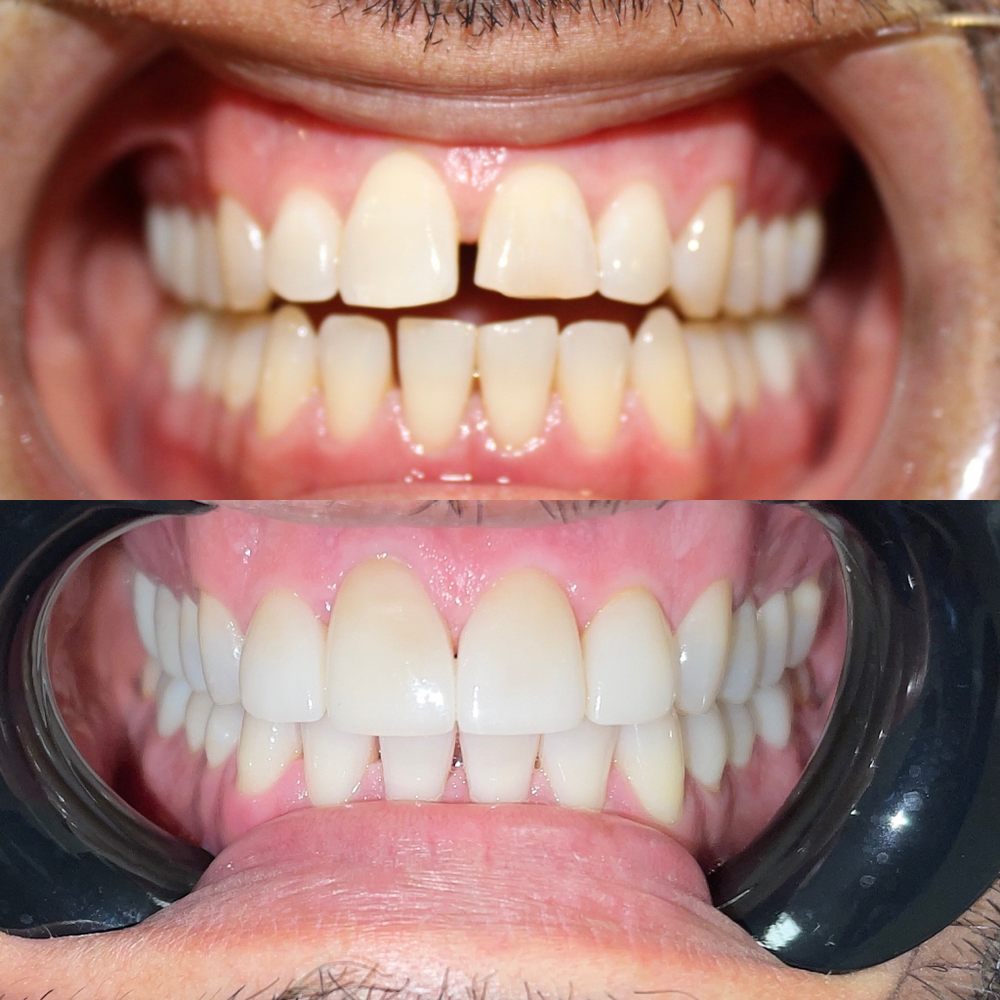 image of business Brite Clean Smiles