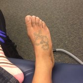 Photo Of Eraser Clinic Laser Tattoo Removal San Antonio Tx United States Photo Of Eraser Clinic Laser Tattoo Removal San Antonio Tx United States