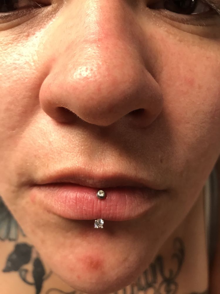Angel Kiss (vertical lip) piercing done with front facing ...