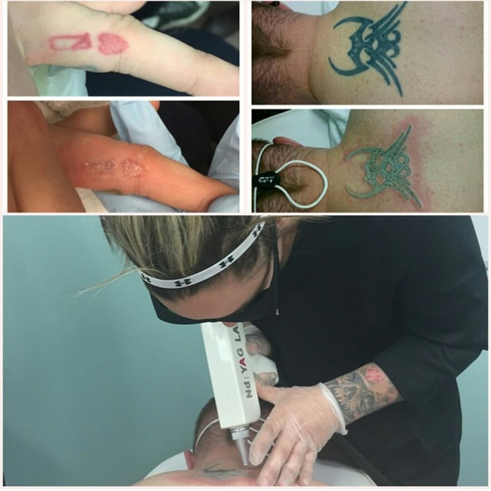 hard knox massage massage therapy 16 49 aero drive ne calgary hard knox massage massage therapy 16 49 aero drive ne calgary