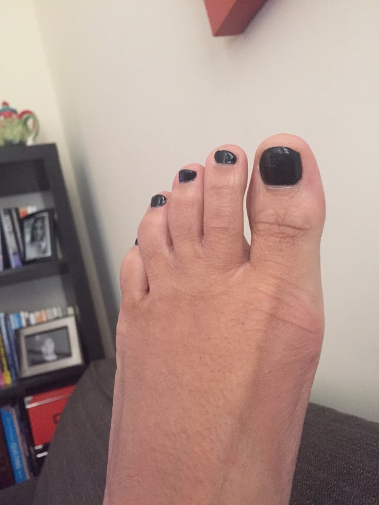 O