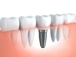 image of business Lake Arbor Dental Associates