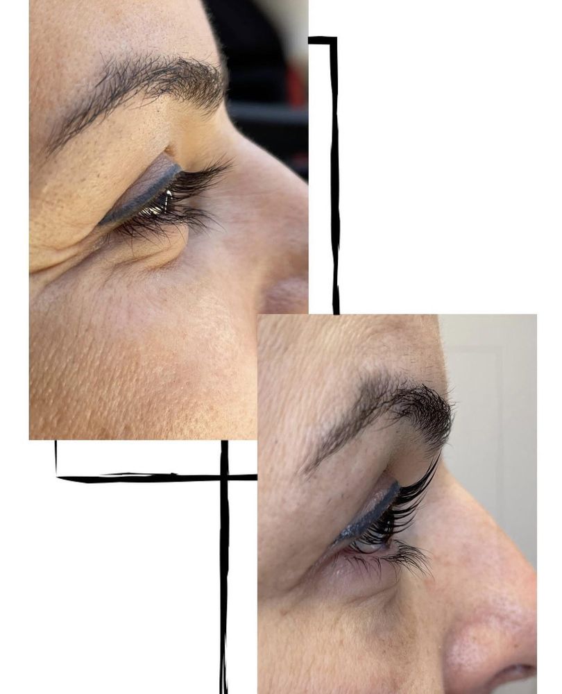 Mila Laser Clinic