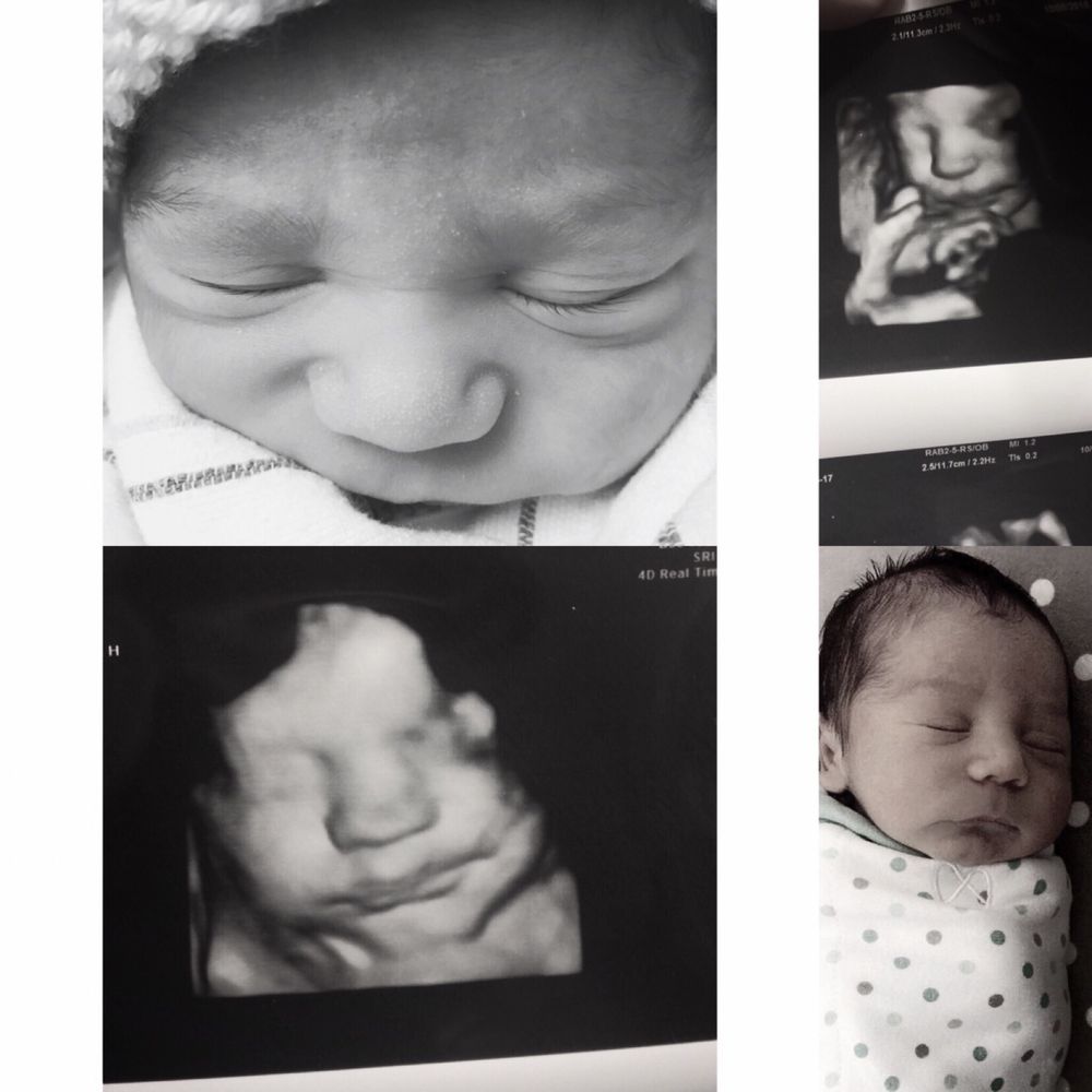 Mommy D Ultrasound Long Beach Ca Mommy D Ultrasound Long Beach Ca