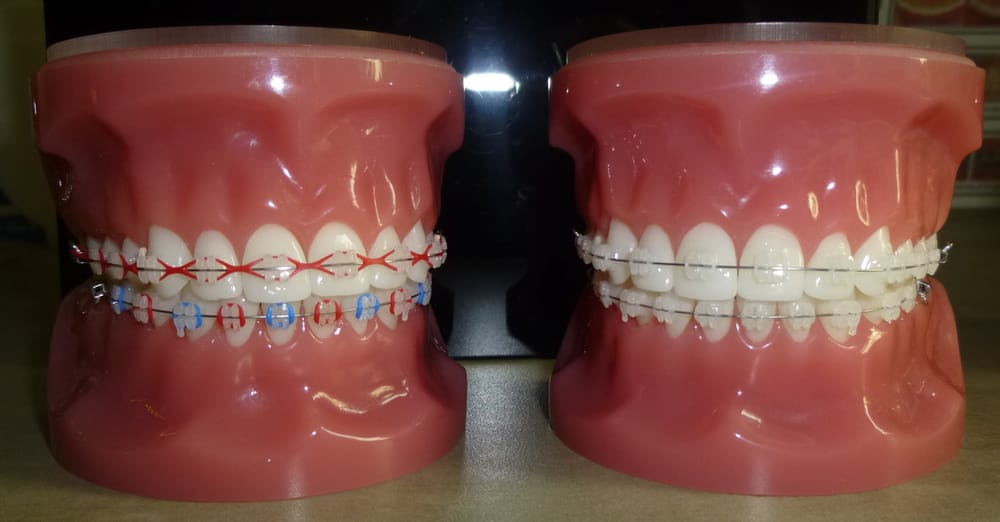 Rice Orthodontics 13 Reviews Orthodontists 8708 Perimeter Park