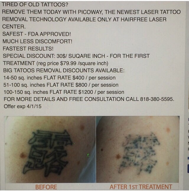 newest most effective picoway laser tattoo removal technology newest most effective picoway laser tattoo removal technology
