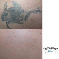 the finery 27 photos u0026 18 reviews tattoo removal 16 s third the finery 27 photos u0026 18 reviews tattoo removal 16 s third