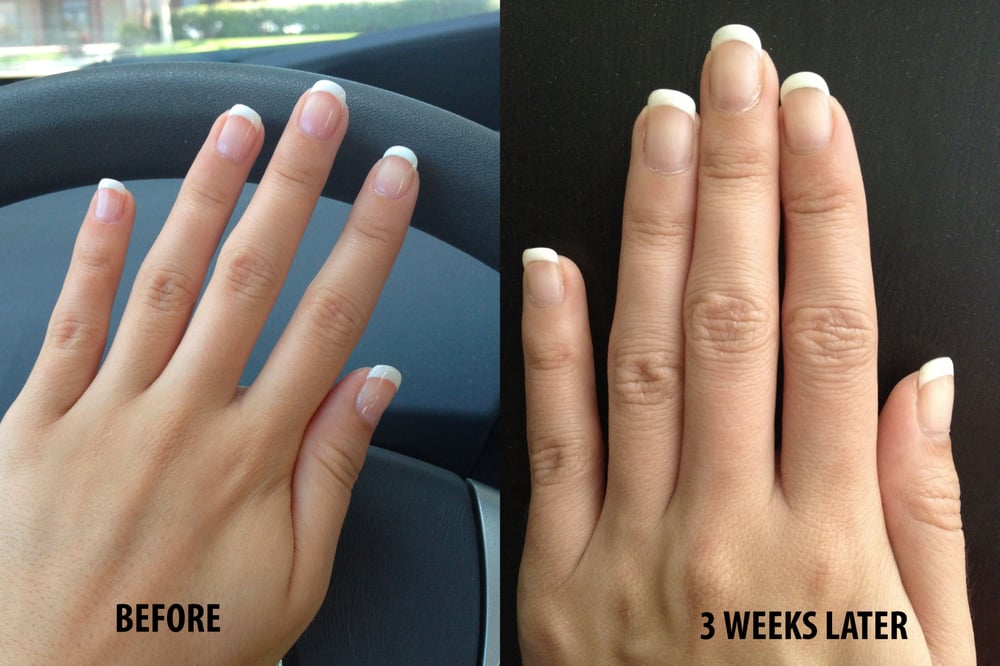 Before And After Of A 3 Week Old Shellac French Manicure Yelp Photo Of Nails Spa By Lauren San Go Ca United States