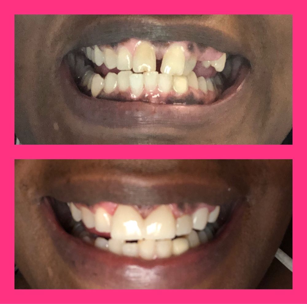 image of business Smile Zone of East Dallas