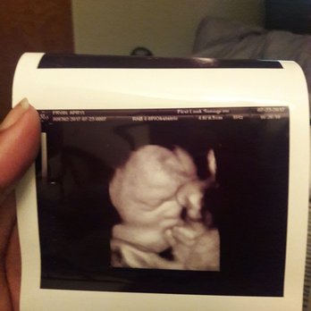 first look sonogram 37