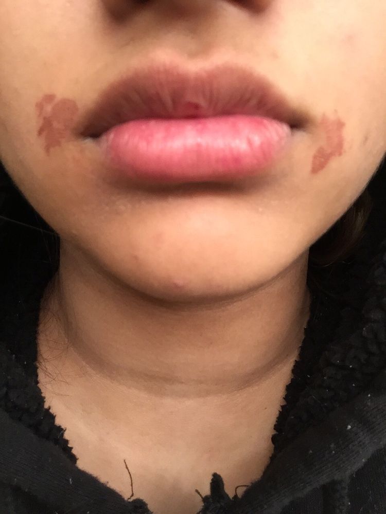 facial waxing burn Watching my wife fuck other men