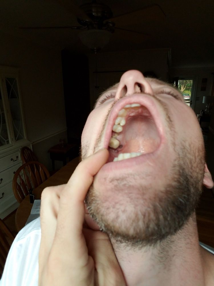 Dentaquest