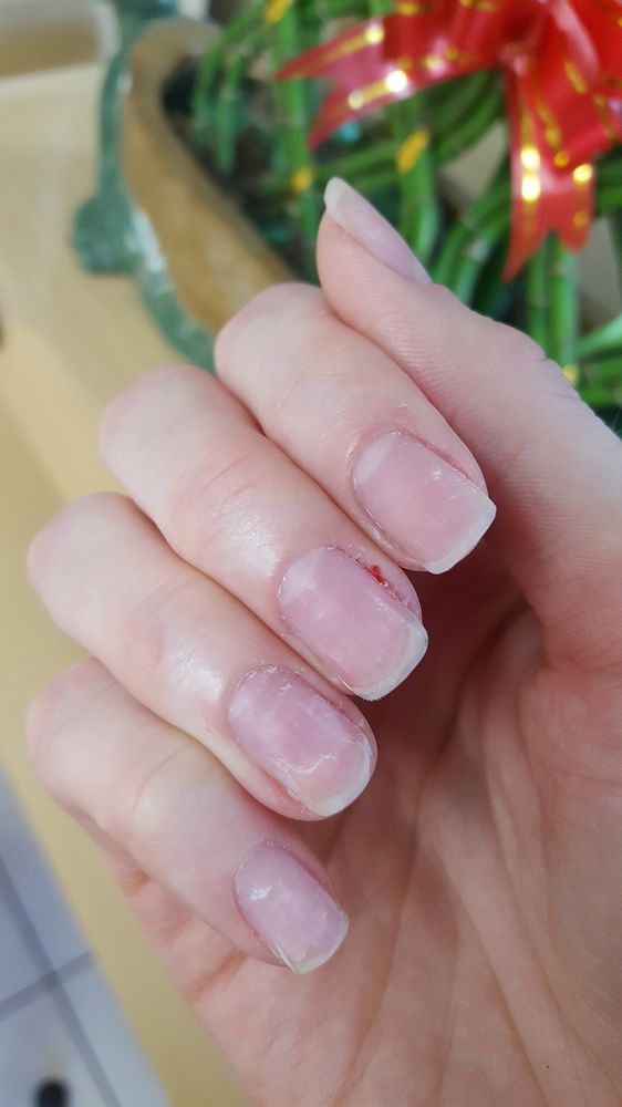 Nails Started Twice This Length Ring Finger Cut Beneath Nail Bed Photo Of Tammy S Nails And Spa Glendale Ca United States Started