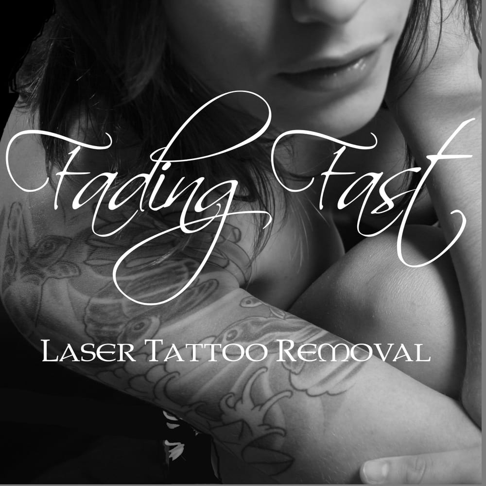 Fading Fast Laser Tattoo Removal - Eliminación de tatuajes 