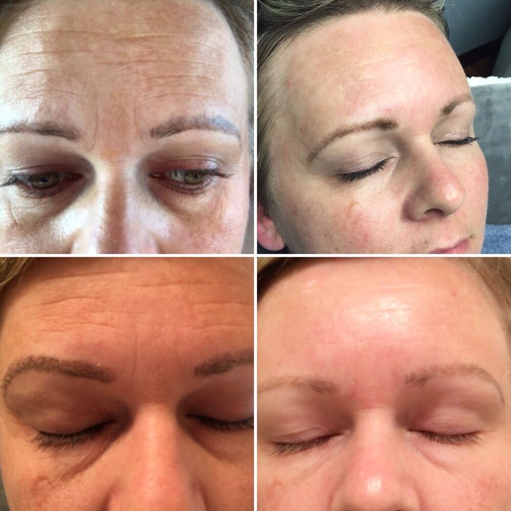 Laser Beauty Medical Spa 35 Photos & 88 Reviews Laser Hair Removal