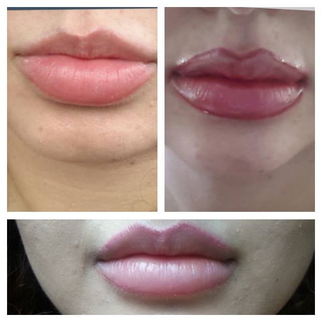 Mila Laser Clinic