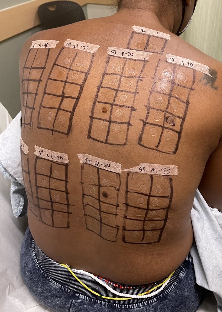 image of business USC Department of Dermatology