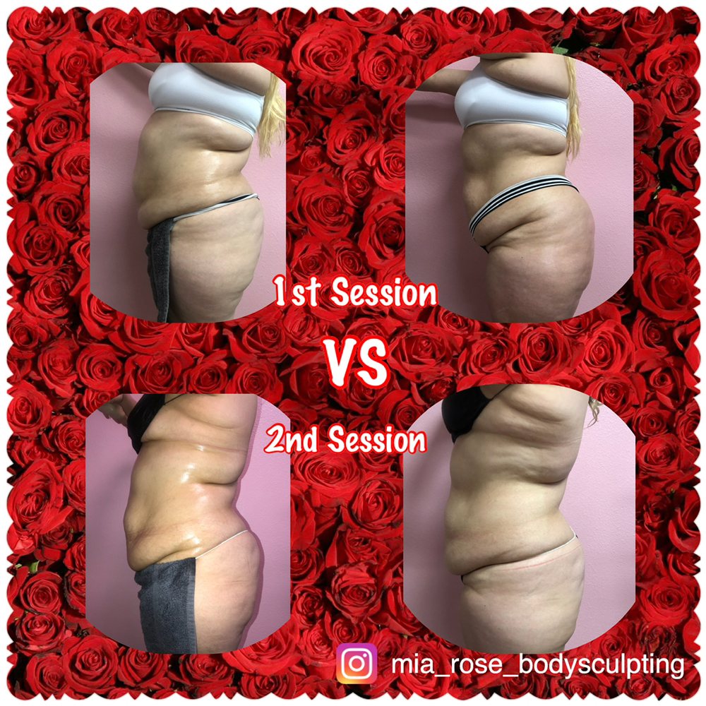Mía Rose Body Sculpting