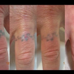undoo tattoo 11 reviews tattoo 250 crummer ln reno nv undoo tattoo 11 reviews tattoo 250 crummer ln reno nv