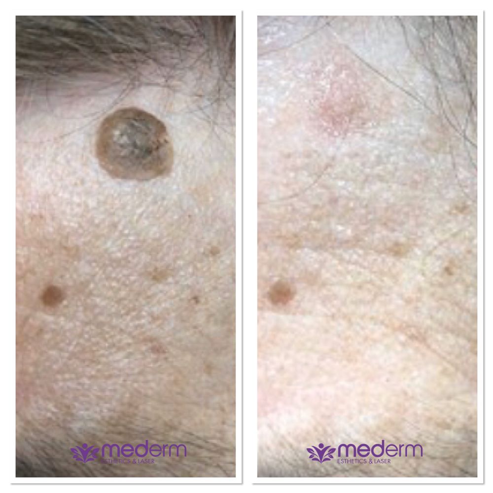 Mederm Esthetics & Laser