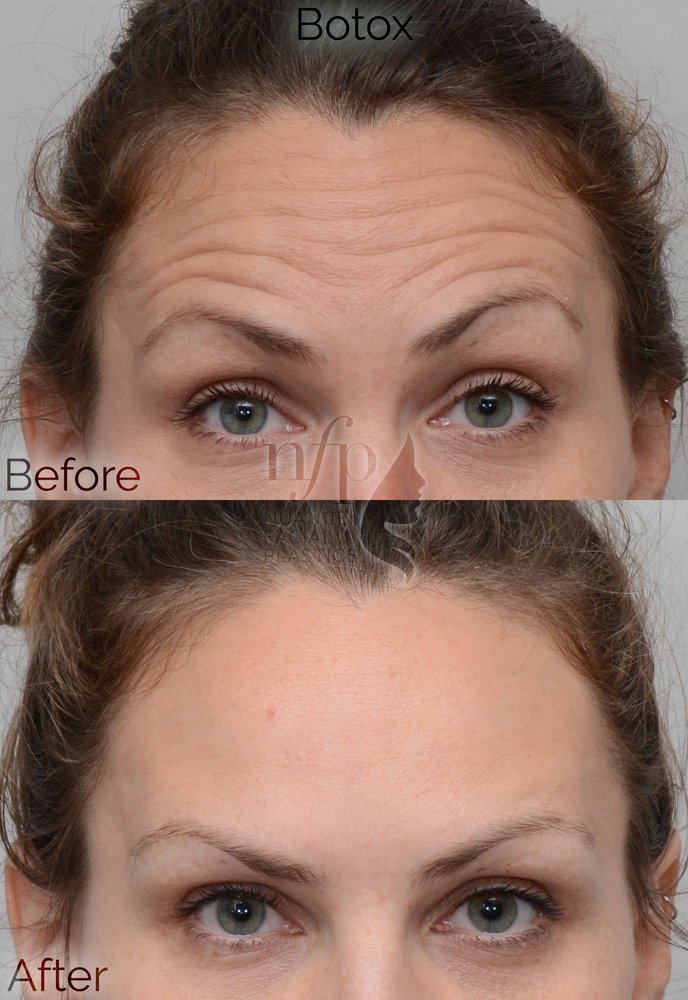 Nuance Facial Plastics