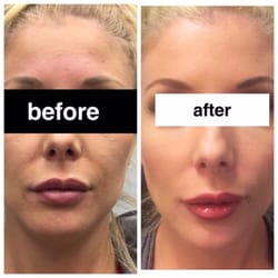 low cost facials in sarasota fl Pussy insertion photo manip
