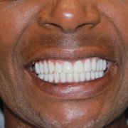 dr golpa dental implants Golpa Dental Implants - 376 Photos dr golpa dental implants Golpa Dental Implants - 376 Photos