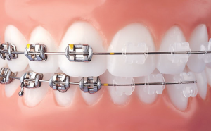 image of business Unique Smiles Dental Wellness