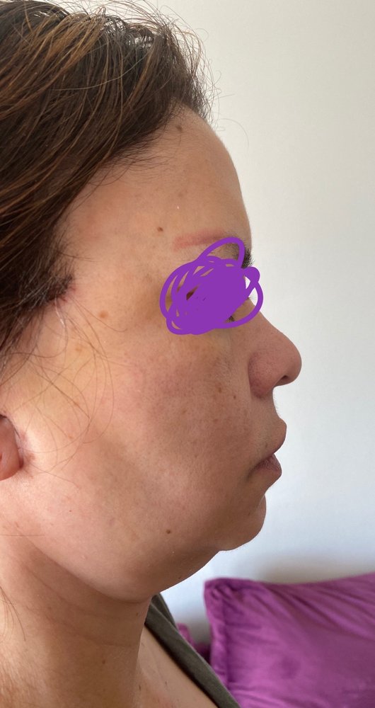 Golden Plastic Surgery