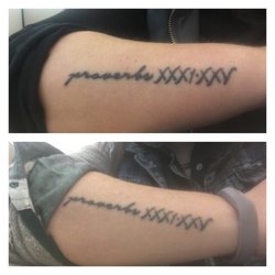 fade fast tattoo removal 18 reviews tattoo removal dallas fade fast tattoo removal 18 reviews tattoo removal dallas