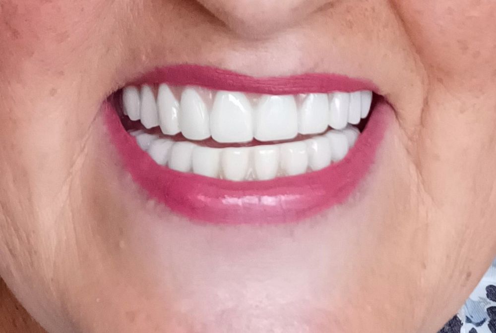 image of business Elite Dental of Summerfield