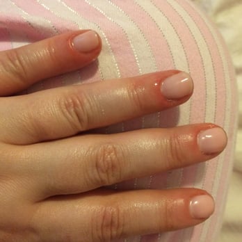 Nails For You Day Spas 1 Eglinton Square Scarborough Toronto Photo Of Nails For You Toronto On Canada Cuticles Swelled Up And