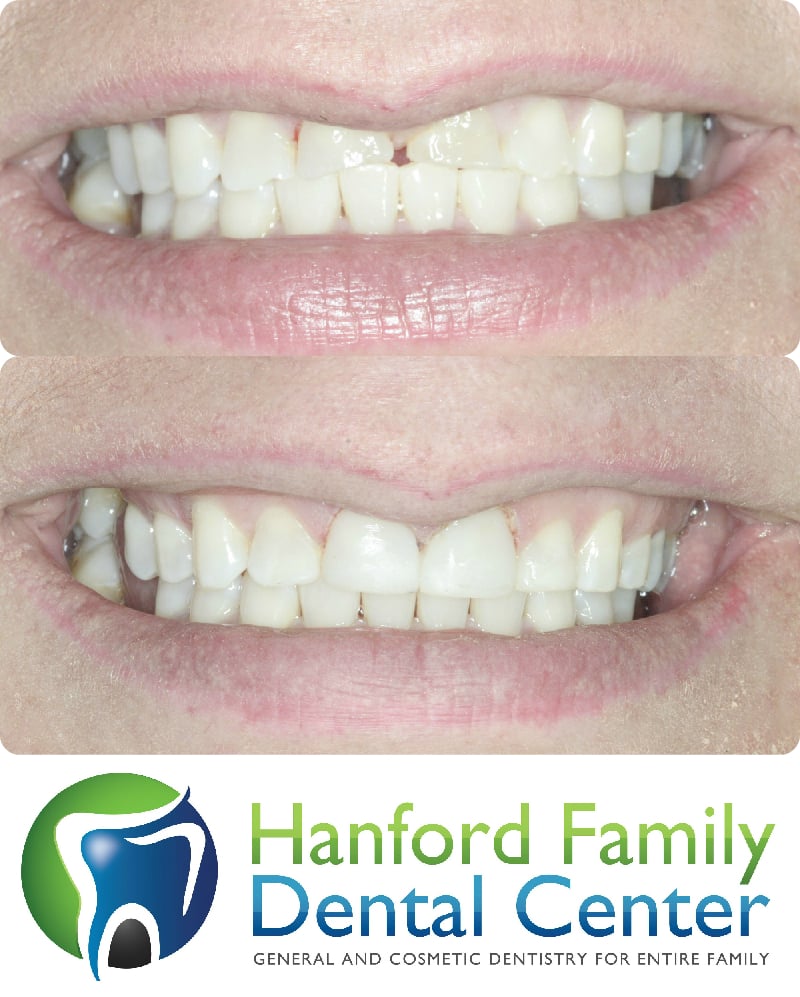 Hanford Family Dental Center 16 Photos & 28 Reviews General