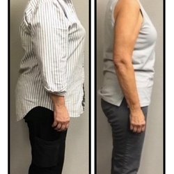 Lemon water helps lose belly fat image 8