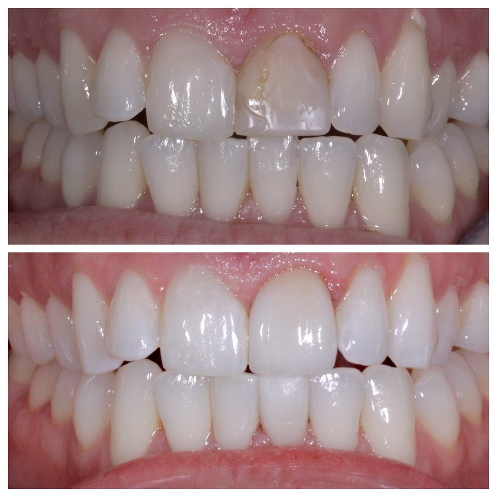 NYC Smile Spa