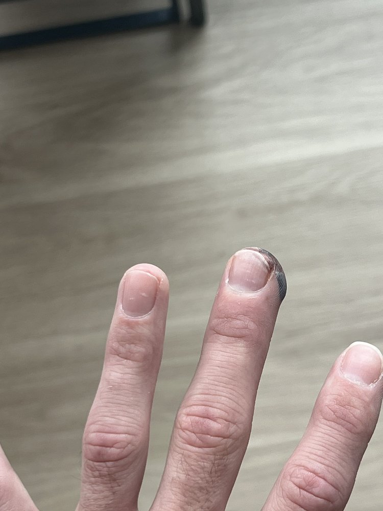 Franciscan Prompt Care at St. Joseph