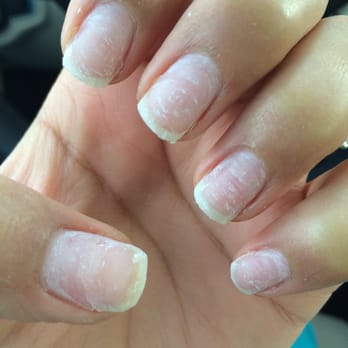 All For Beauty 22 Photos 33 Reviews Hair Removal 1305 Removed The Acrylic Photo Of All For Beauty Fairfield Ca United States Nails After Having