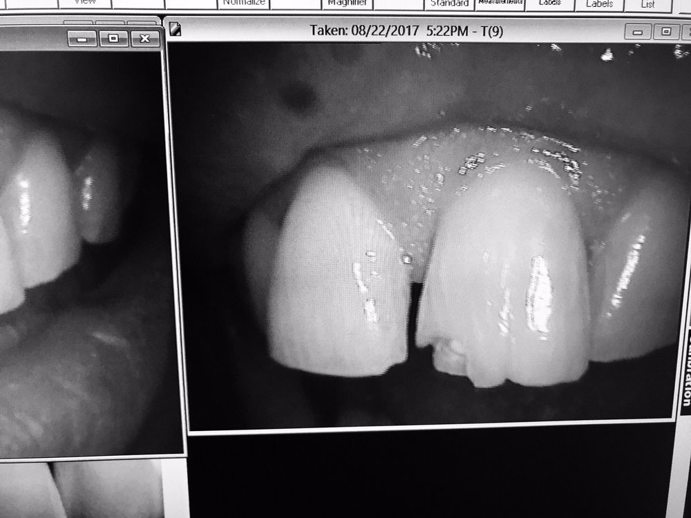 Photos for Lakewood Dental Center Yelp