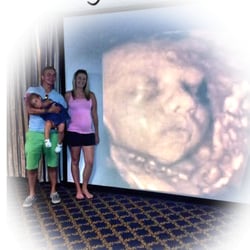 a baby visit 4d ultrasound 46 photos 121 reviews a baby visit 4d ultrasound 46 photos 121 reviews