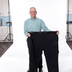 Safe surgery to remove belly fat picture 3