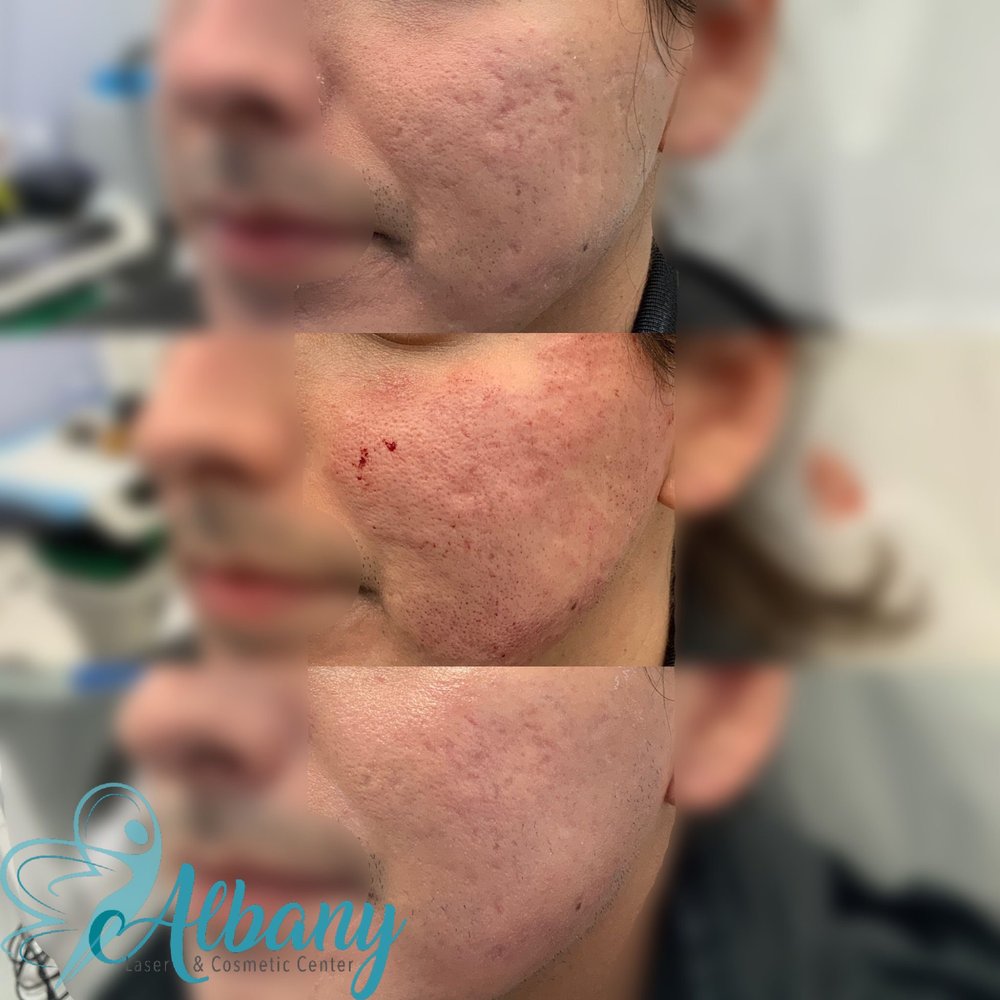 Albany Cosmetic & Laser Centre